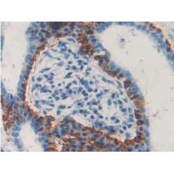 C-Type Lectin Domain Family 4, Member M (CLEC4M) Antibody