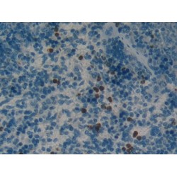 Fatty Acid-Binding Protein, Intestinal (FABP2) Antibody