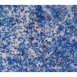 Fatty Acid-Binding Protein, Intestinal (FABP2) Antibody