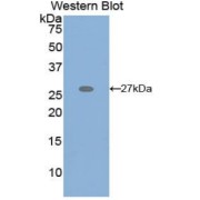 Western blot analysis of the recombinant protein.