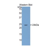Western blot analysis of the recombinant protein.