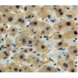 Glyceraldehyde-3-Phosphate Dehydrogenase (GAPDH) Antibody