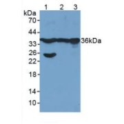 abx104162