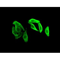 Glyceraldehyde-3-Phosphate Dehydrogenase (GAPDH) Antibody