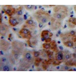 Immunoglobulin Lambda Like Polypeptide 1 (IGLL1) Antibody