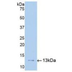 Urokinase Plasminogen Activator Surface Receptor (PLAUR) Antibody