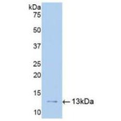 Plasminogen Activator, Urokinase Receptor (uPAR) Antibody