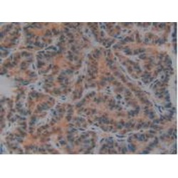 Urokinase Plasminogen Activator Surface Receptor (PLAUR) Antibody