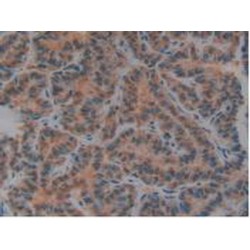 Plasminogen Activator, Urokinase Receptor (uPAR) Antibody