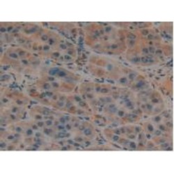 Urokinase Plasminogen Activator Surface Receptor (PLAUR) Antibody