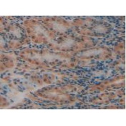 Urokinase Plasminogen Activator Surface Receptor (PLAUR) Antibody