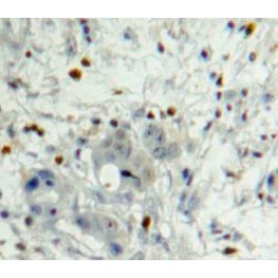 Platelet Derived Growth Factor Subunit B (PDGFB) Antibody