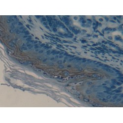 Serine Peptidase Inhibitor Kazal Type 5 (SPINK5) Antibody