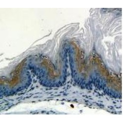 Serine Peptidase Inhibitor Kazal Type 5 (SPINK5) Antibody