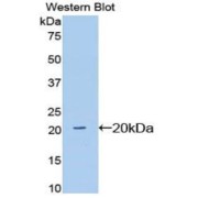 abx104188