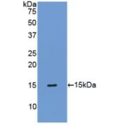abx104192