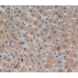 Metalloproteinase Inhibitor 1 (TIMP1) Antibody