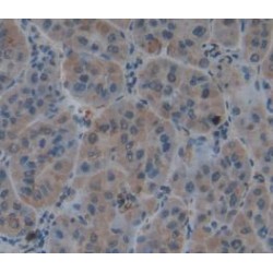 Metalloproteinase Inhibitor 1 (TIMP1) Antibody