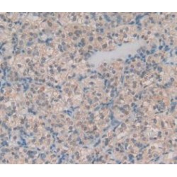 Metalloproteinase Inhibitor 1 (TIMP1) Antibody