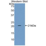 abx104193
