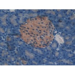 Metalloproteinase Inhibitor 4 (TIMP4) Antibody
