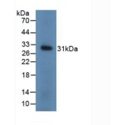 abx104207
