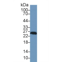 Ubiquitin Carboxyl Terminal Hydrolase L1 (UCHL1) Antibody