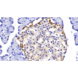Ubiquitin Carboxyl Terminal Hydrolase L1 (UCHL1) Antibody
