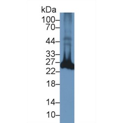 Ubiquitin Carboxyl Terminal Hydrolase L1 (UCHL1) Antibody