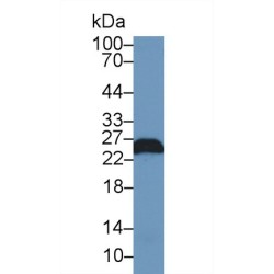 Ubiquitin Carboxyl Terminal Hydrolase L1 (UCHL1) Antibody