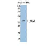 abx104209