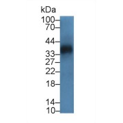abx104211