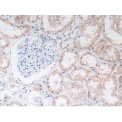 Dimethylarginine Dimethylaminohydrolase 1 (DDAH1) Antibody