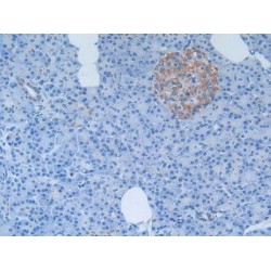 Dimethylarginine Dimethylaminohydrolase 1 (DDAH1) Antibody