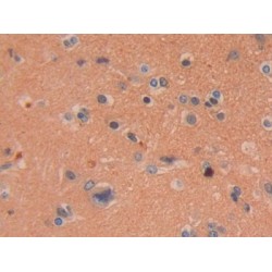 Dimethylarginine Dimethylaminohydrolase 2 (DDAH2) Antibody
