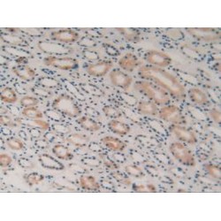 Hydroxymethylglutaryl-CoA Synthase, Cytoplasmic (HMGCS1) Antibody