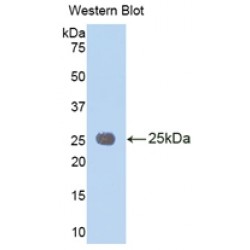 Interleukin 1 Receptor Accessory Protein (IL1RAP) Antibody