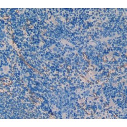 Mothers Against Decapentaplegic Homolog 1 (Smad1) Antibody