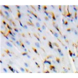 Mothers Against Decapentaplegic Homolog 2 (Smad2) Antibody