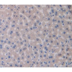 Mothers Against Decapentaplegic Homolog 3 (Smad3) Antibody