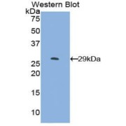 Western blot analysis of the recombinant protein.