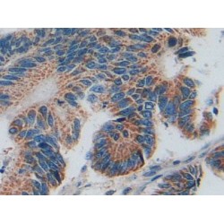 Mothers Against Decapentaplegic Homolog 5 (Smad5) Antibody