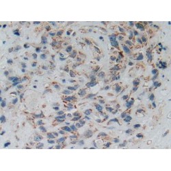 Mothers Against Decapentaplegic Homolog 5 (Smad5) Antibody