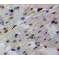 Mothers Against Decapentaplegic Homolog 6 (Smad6) Antibody