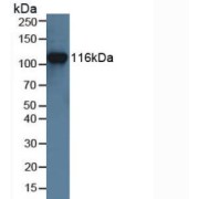 WB analysis of Human Jurkat Cells.