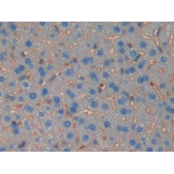 Muscle, Skeletal, Receptor Tyrosine Kinase (MUSK) Antibody