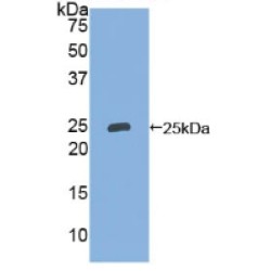 Neutrophil Gelatinase Associated Lipocalin / NGAL (LCN2) Antibody