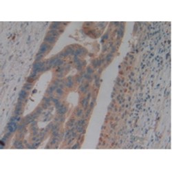 Neutrophil Gelatinase Associated Lipocalin / NGAL (LCN2) Antibody