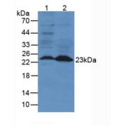 Western blot analysis of (1) Mouse Lung Tissue and (2) Mouse Spleen Tissue.