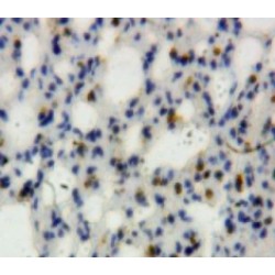 Neutrophil Gelatinase Associated Lipocalin / NGAL (LCN2) Antibody